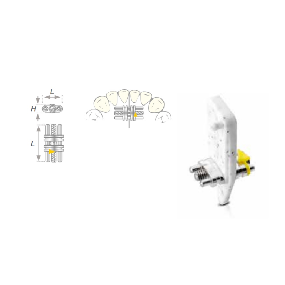 Vector 100 écarteur standard mini (10)