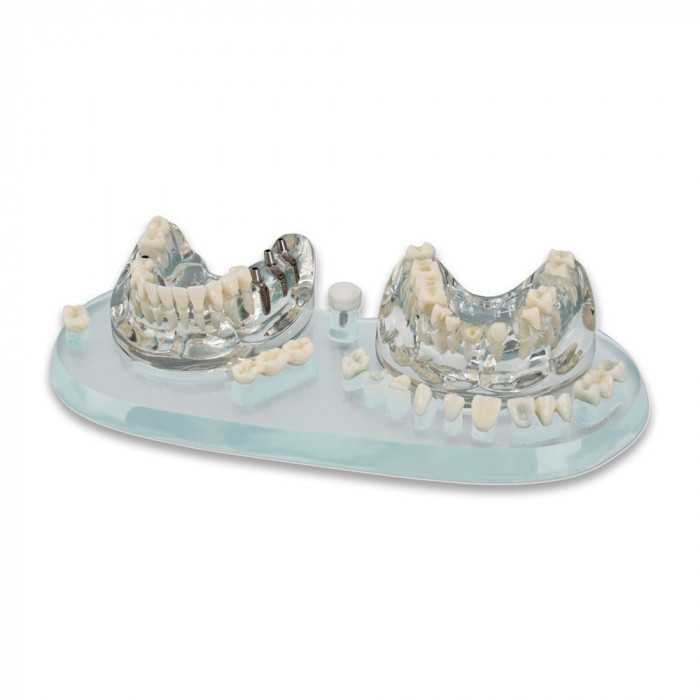 STUDY MODEL DEMO IMOLANT C + B 355638 HAGER STUDY MODEL DEMO IMOLANT C + B 355638 HAGER