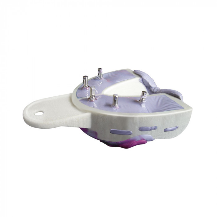 Miratrays Implant Kit INTRO Miratrays Implant Kit INTRO