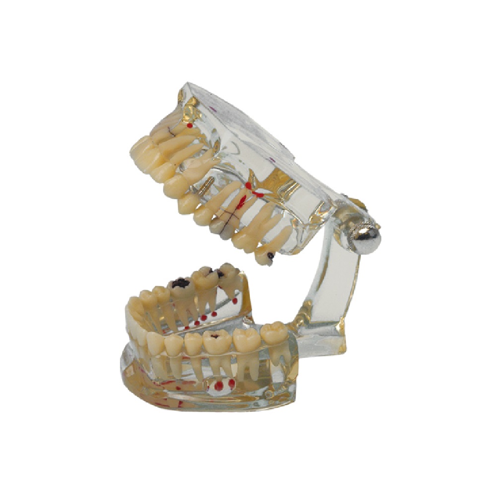 Modèle d'étude transparent Study Model
