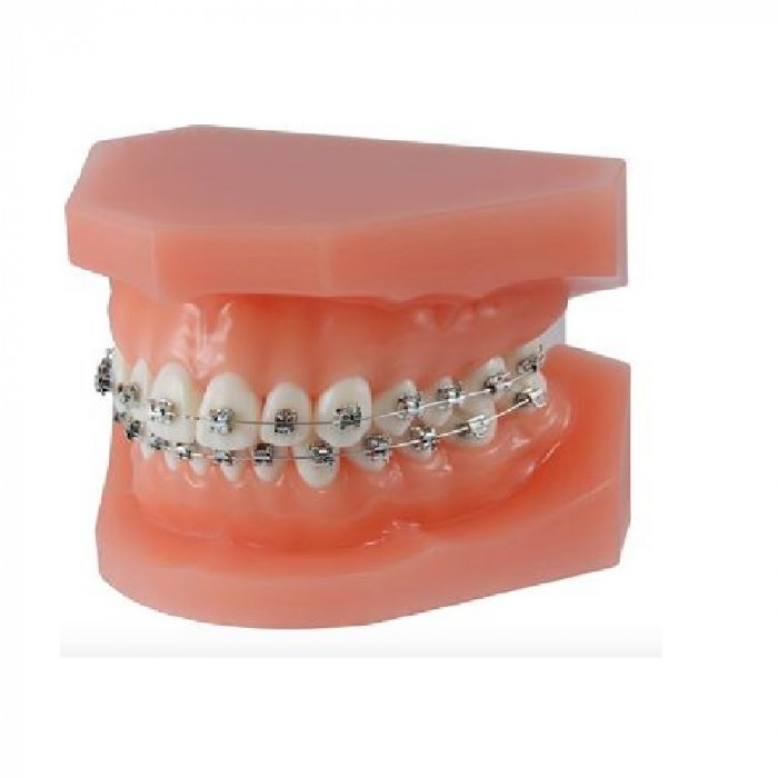 Modèle de démonstration orthodontique M51 Modèle de démonstration orthodontique M51