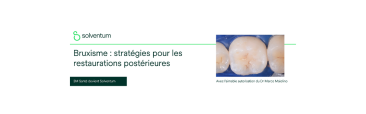 Bruxisme et restaurations postérieures : choisir les solutions adaptées pour une santé bucco-dentaire durable