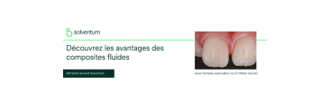 Les composites fluides : comment les intégrer à votre protocole clinique ?