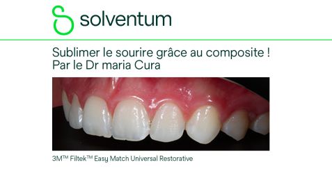 Sublimer le sourire grâce au composite !