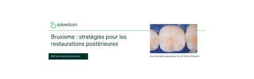 Bruxisme et restaurations postérieures : choisir les solutions adaptées pour une santé bucco-dentaire durable