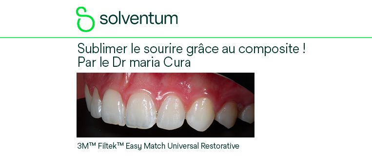 Sublimer le sourire grâce au composite !