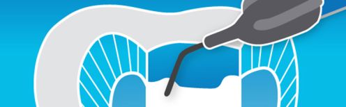 Composites fluides : 6 conseils pour maîtriser l’usage