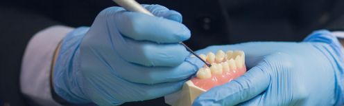 Tout savoir sur le rebasage dentaire