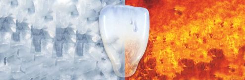 VivaSens, pour dents sensibles
