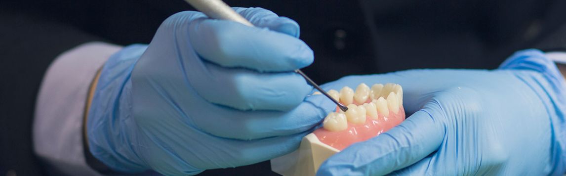 Tout savoir sur le rebasage dentaire
