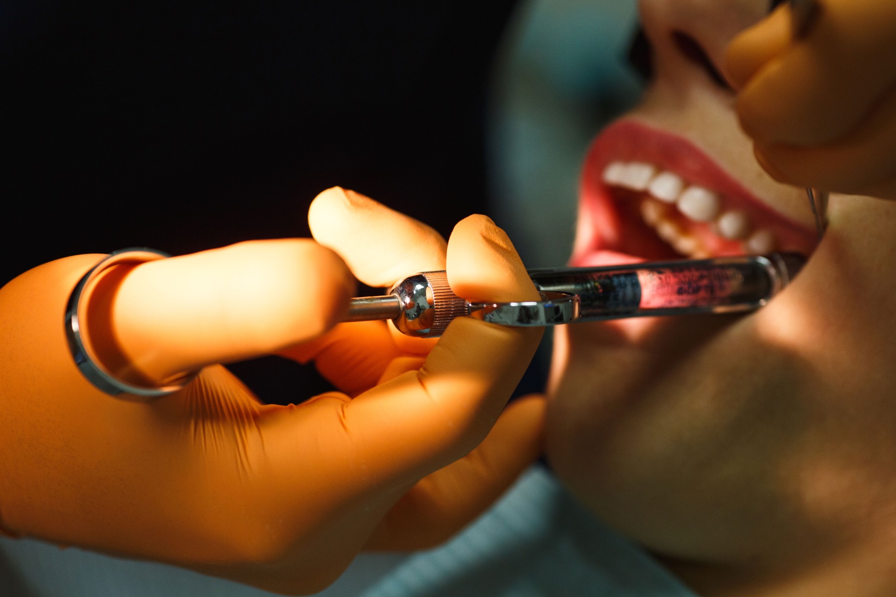 Gros plan sur l'administration d'une injection d'anesthésie dentaire.