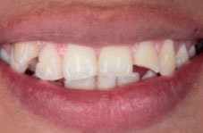 Close-up of smile