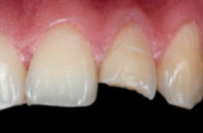 Photograph with 1:1 magnification ratio