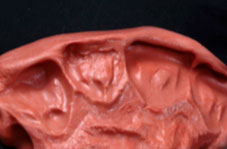 Unmodified silicone impression
