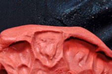 Modified silicone impression