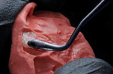 Packing resin into the impression