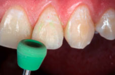 Green cup polisher