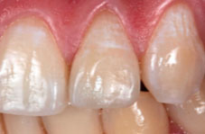 Photograph 1 after polishing