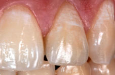 Photograph 2 after polishing