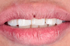 Photograph: Close-up in repose