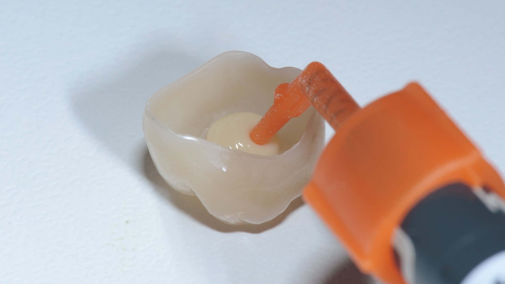 Application du ciment-composite 3M™ RelyX™ Universal.