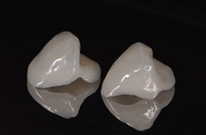 Fabrication des pièces prothétiques2